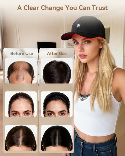 Cordless Red Light Therapy Cap – 660 nm Red & 850 nm Near-Infrared, Rechargeable 2000mAh - image 2